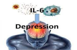 IL-6 depression